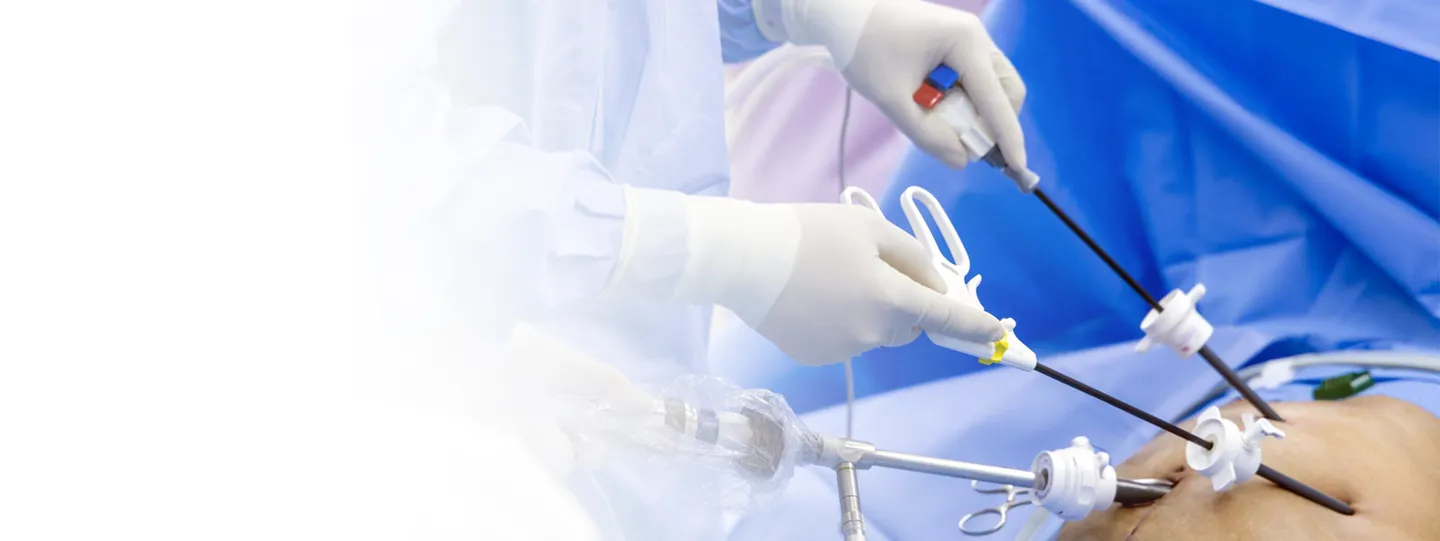 Laparoscopy Surgery: Types, Procedure, Recovery, Stitches & Success Rate in India